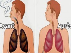 poumons fumer avant après